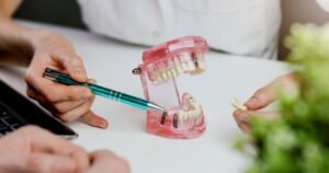 a dentist shows a model of dental implants to a patient